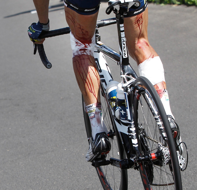 tour de france cuisse barbelés