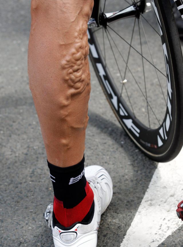 Un coureur mutant dopé à l'EPO...